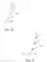 Fig. 15 - MIXED USE FIXATION ELEMENTS FOR ENDOLUMINAL FILTERS