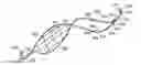 Fig. 01 - ENHANCED FLUOROGENIC ENDOLUMINAL FILTER STRUCTURE