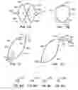 Fig. 07 - ENHANCED FLUOROGENIC ENDOLUMINAL FILTER STRUCTURE