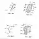Fig. 08 - ENHANCED FLUOROGENIC ENDOLUMINAL FILTER STRUCTURE