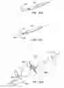 Fig. 37 - ENHANCED FLUOROGENIC ENDOLUMINAL FILTER STRUCTURE