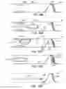 Fig. 43 - ENHANCED FLUOROGENIC ENDOLUMINAL FILTER STRUCTURE