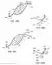 Fig. 53 - ENHANCED FLUOROGENIC ENDOLUMINAL FILTER STRUCTURE