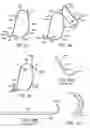 Fig. 56 - ENHANCED FLUOROGENIC ENDOLUMINAL FILTER STRUCTURE