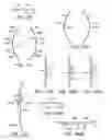 Fig. 57 - ENHANCED FLUOROGENIC ENDOLUMINAL FILTER STRUCTURE