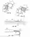 Fig. 58 - ENHANCED FLUOROGENIC ENDOLUMINAL FILTER STRUCTURE
