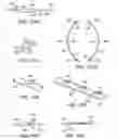 Fig. 59 - ENHANCED FLUOROGENIC ENDOLUMINAL FILTER STRUCTURE