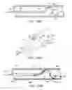 Fig. 65 - ENHANCED FLUOROGENIC ENDOLUMINAL FILTER STRUCTURE