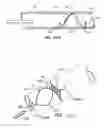 Fig. 66 - ENHANCED FLUOROGENIC ENDOLUMINAL FILTER STRUCTURE