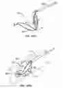 Fig. 69 - ENHANCED FLUOROGENIC ENDOLUMINAL FILTER STRUCTURE