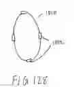 Fig. 71 - ENHANCED FLUOROGENIC ENDOLUMINAL FILTER STRUCTURE