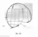 Fig. 79 - ENHANCED FLUOROGENIC ENDOLUMINAL FILTER STRUCTURE