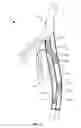 Fig. 03 - Differential dilation stent and method of use