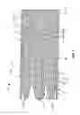 Fig. 06 - Differential dilation stent and method of use