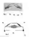 Fig. 02 - Systems, Devices, and/or Methods for Managing Implantable Devices