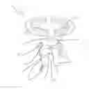 Fig. 01 - OSSICULAR PROSTHESIS HAVING SPIKES