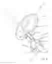 Fig. 09 - OSSICULAR PROSTHESIS HAVING SPIKES
