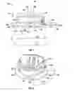 Fig. 02 - Morphological sewing cuff assembly for heart valve