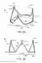 Fig. 04 - Prosthetic valved conduits with mechanically coupled leaflets