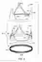 Fig. 08 - Prosthetic valved conduits with mechanically coupled leaflets