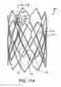 Fig. 12 - Prosthetic valved conduits with mechanically coupled leaflets