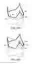 Fig. 34 - Prosthetic valved conduits with mechanically coupled leaflets