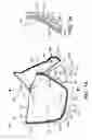 Fig. 02 - Prosthetic valves with mechanically coupled leaflets