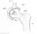Fig. 01 - Hip joint device and method