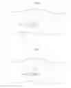 Fig. 03 - Hip joint device and method