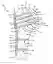 Fig. 01 - System for replacement of at least a portion of a carpal articular surface of a radius