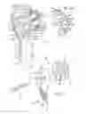Fig. 05 - System for replacement of at least a portion of a carpal articular surface of a radius