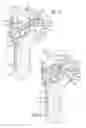Fig. 06 - System for replacement of at least a portion of a carpal articular surface of a radius