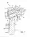 Fig. 08 - System for replacement of at least a portion of a carpal articular surface of a radius