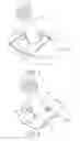 Fig. 02 - MODULAR GLENOID PROSTHESIS