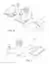 Fig. 05 - MODULAR GLENOID PROSTHESIS
