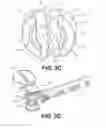 Fig. 08 - Vertebral implants and methods for installation thereof