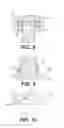 Fig. 13 - Vertebral implants and methods for installation thereof