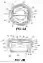Fig. 05 - Vertebral implants and methods for installation thereof