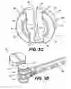 Fig. 08 - Vertebral implants and methods for installation thereof