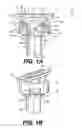 Fig. 02 - Vertebral implants and methods for installation thereof