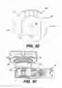 Fig. 09 - Vertebral implants and methods for installation thereof