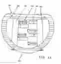 Fig. 17 - Device for securing an implant to tissue