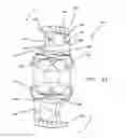 Fig. 27 - Device for securing an implant to tissue
