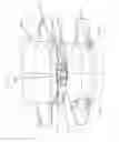 Fig. 63 - Device for securing an implant to tissue