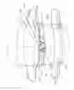 Fig. 65 - Device for securing an implant to tissue