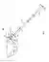 Fig. 03 - PATIENT-MATCHED ACETABULAR ALIGNMENT TOOL