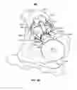 Fig. 05 - PATIENT-MATCHED ACETABULAR ALIGNMENT TOOL