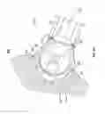 Fig. 06 - PATIENT-MATCHED ACETABULAR ALIGNMENT TOOL