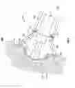 Fig. 08 - PATIENT-MATCHED ACETABULAR ALIGNMENT TOOL