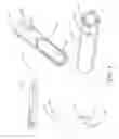 Fig. 02 - Sacroiliac joint fusion systems and methods